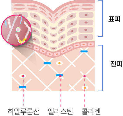 피부 진피 속 콜라겐 엘라스틴 히알루론산